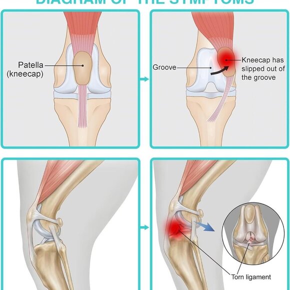 Lispoo Hind Leg Brace for Dog (Medium) - Picture 3 of 4